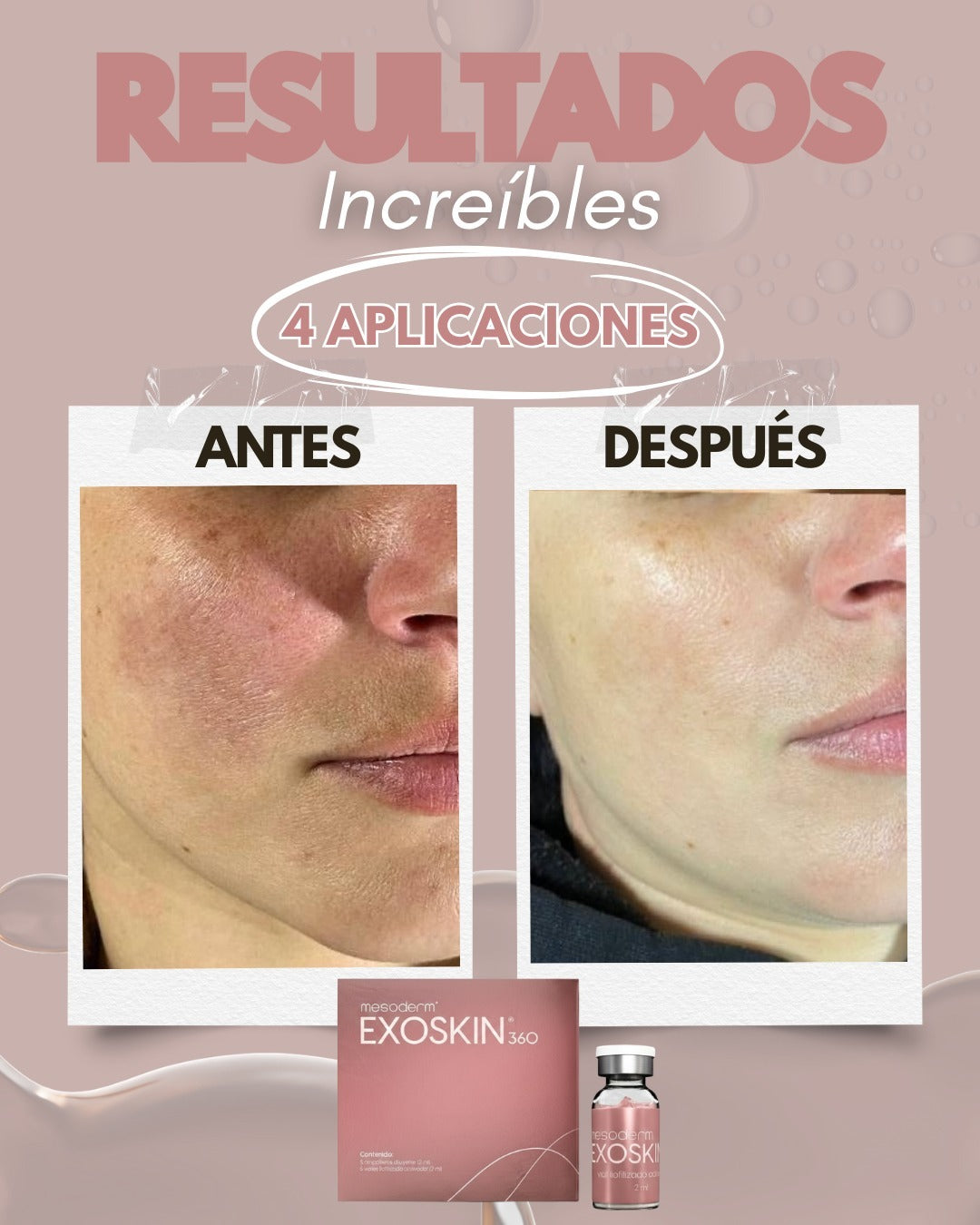 EXOSKIN 360 3 Cajas