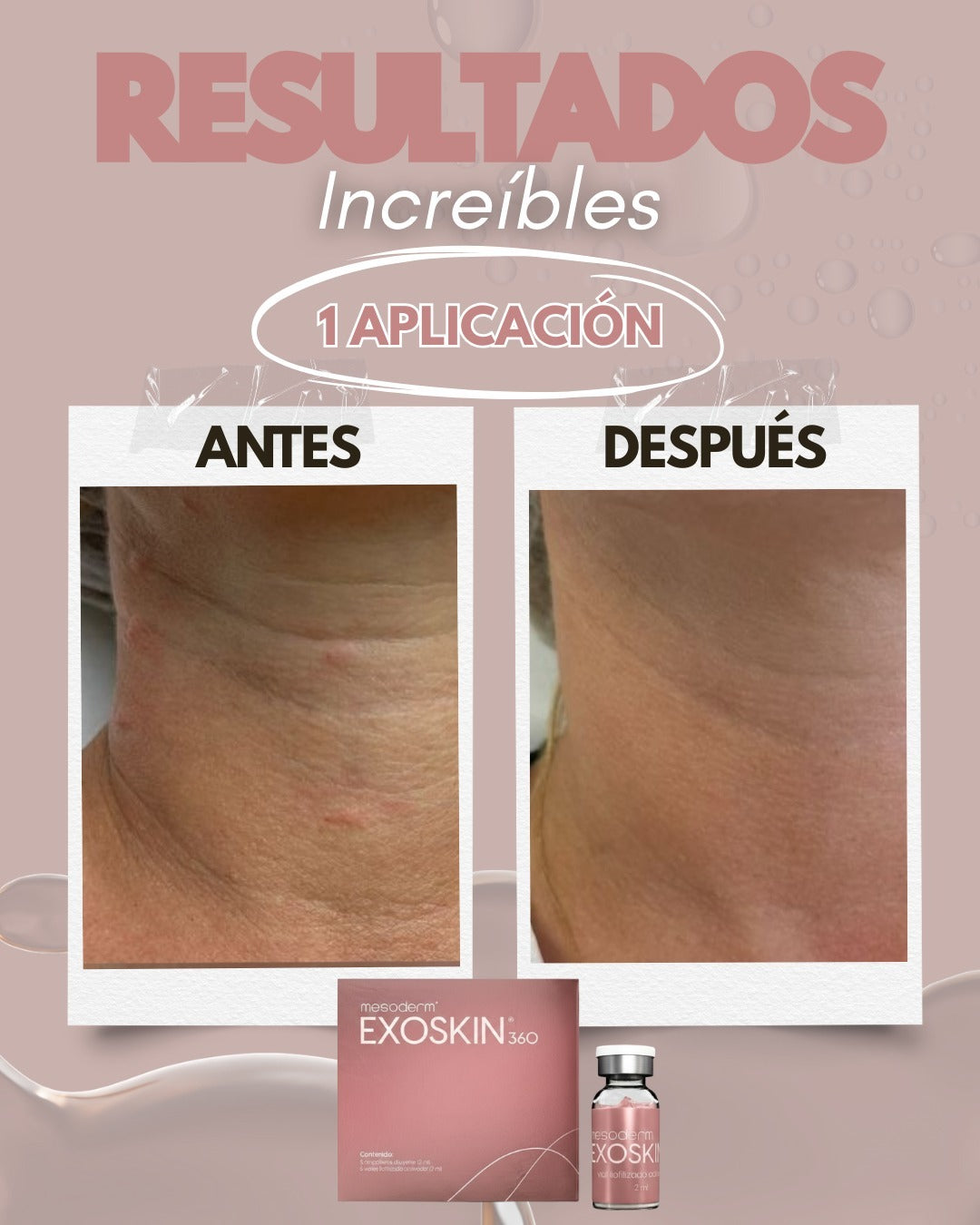 EXOSKIN 360 3 Cajas