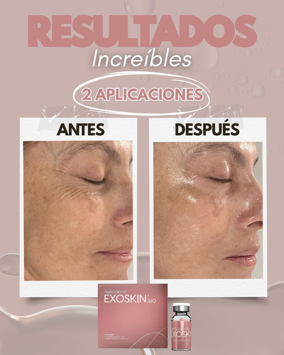 EXOSKIN 360 3 Cajas
